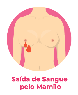 saída de sangue pelo mamilo